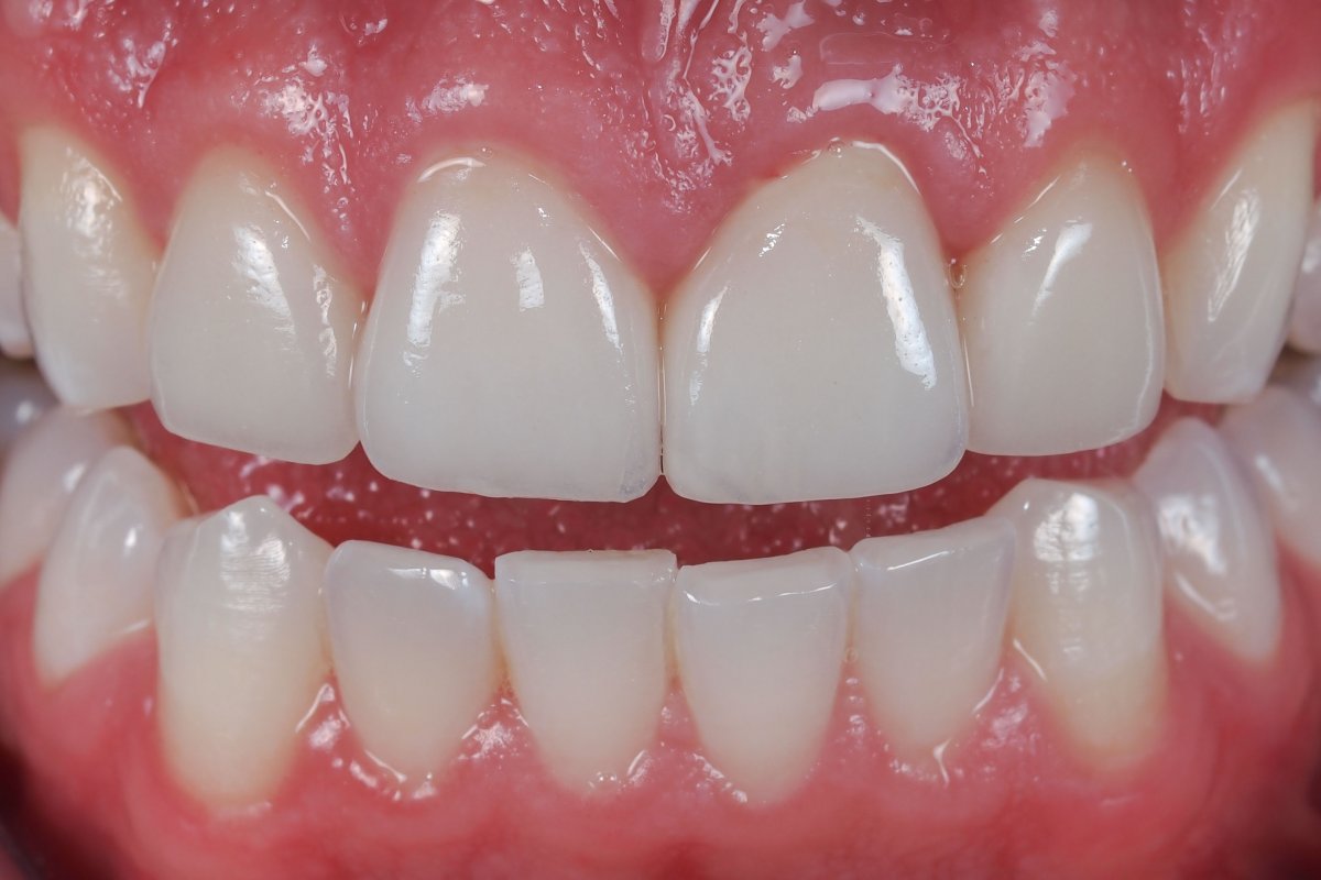 estetica dentara Bucuresti sector 1, Dental Garant
