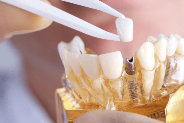 implant dentar, clinica stomatologica , stomatologie Bucuresti